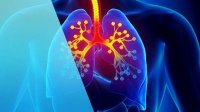Fibrosis quística afecta principalmente los pulmones: IMSS Chiapas