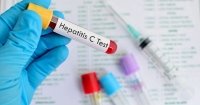 Más de un millón de mexicanos desconocen que padecen hepatitis C
